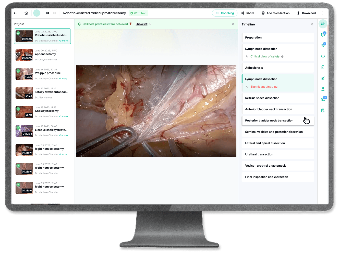 Quality Optimization